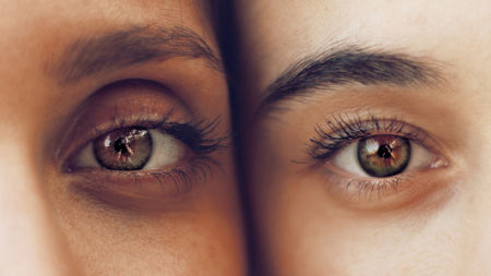 eye dark circle treatment in hyderabad