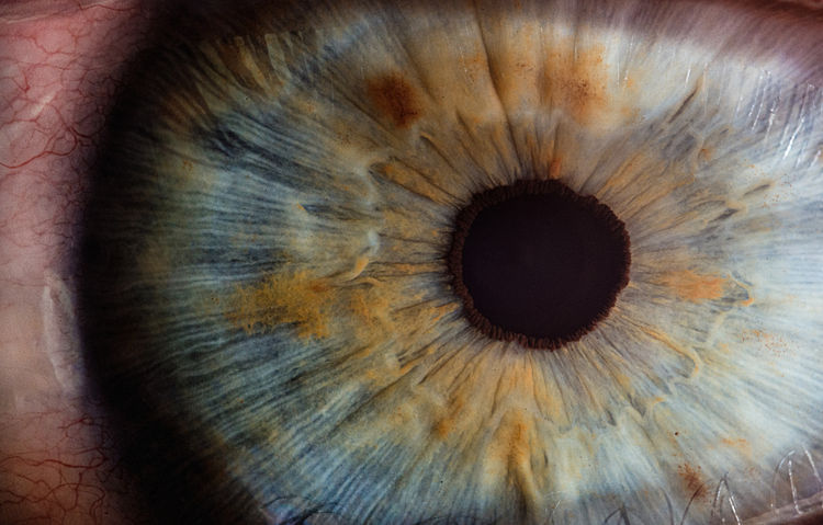 What is Oculoplasty and what conditions does it treat?